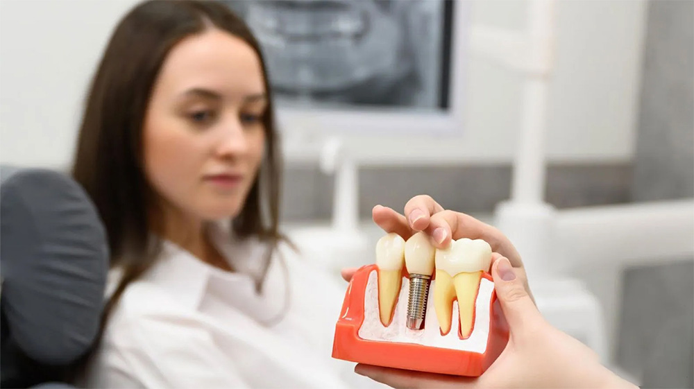 💡 Implantes Dentales a Plazos en España: Costes, Clínicas y Opciones de Financiación que Sí Funcionan